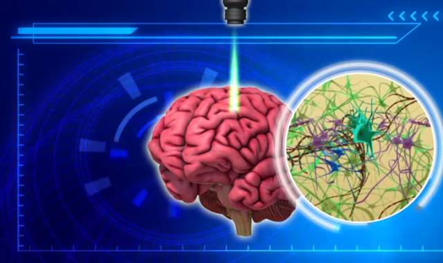 第三步，针对患者大脑进行激光刺激 图自Star 2新闻网