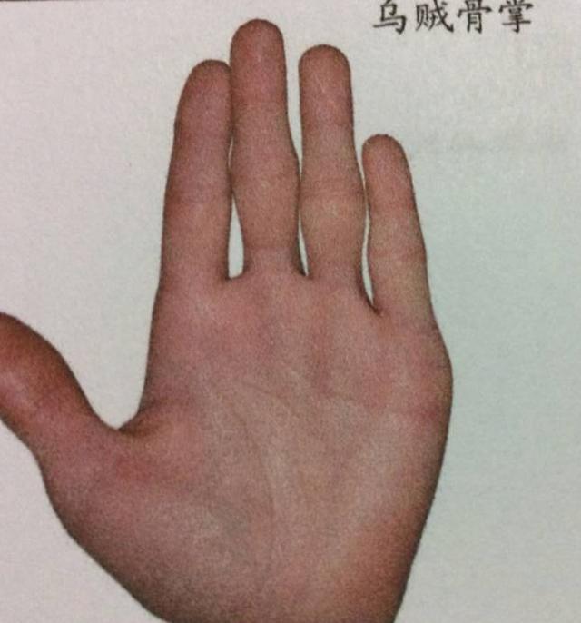 食指根部(巽卦)有竖纹,反应的是肝胆