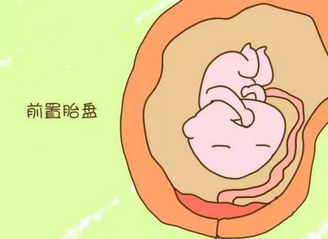 听很多人说:怀孕后不要吃辣椒,这对钟爱辣椒的孕妈咪来说无疑是一道晴天霹雳。面对诱人的辣椒,再看看肚子里心爱的宝宝,孕妈咪左右为难。怀孕了还可以吃辣椒吗?孕妇可以吃辣椒吗?孕妇吃辣椒对胎儿有什么影响?跟着小编一起来看下吧。 怀孕之后可以吃辣椒吗? 对于一些从小吃着辣椒长大的女性来说,如果怀孕之后让她们不要吃辣椒的话,那真是太痛苦了,她们会饭都吃不下去,真的会这样子。怀孕之后有关专家们就说了,是可以适当吃一点辣椒的,但不能吃得过多,吃得过多对胎儿造成刺激或引起流产。想吃辣椒的女性们就可以放心了,适当地吃