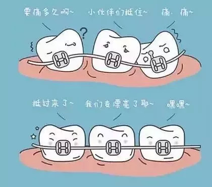 牙齿矫正的9大误区,你听信过多少