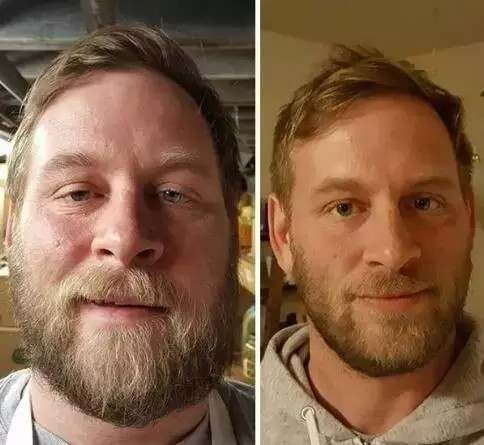 震惊|戒酒前后的对比 <wbr>瘦不下来就是因为这个原因