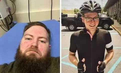 震惊|戒酒前后的对比 <wbr>瘦不下来就是因为这个原因