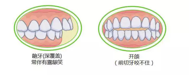 安抚奶嘴应该如何使用?