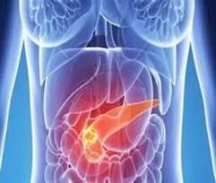 不吃早饭、晚上酒肉吃喝……小心胰腺炎找上你!