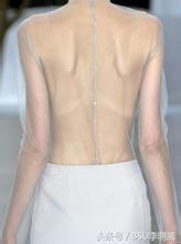 翼状肩，美丽的错误