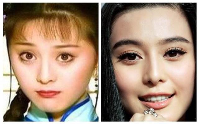 baby天生双眼皮,为什么还要做双眼皮手术?