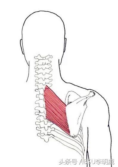 翼状肩,真是一个美丽的错误。 翼状肩,美丽的错误