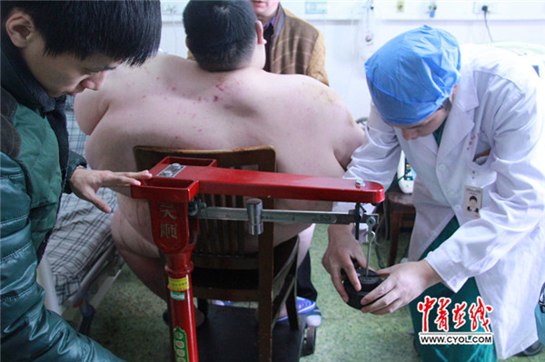 40斤的中国“第一胖”切胃减肥
