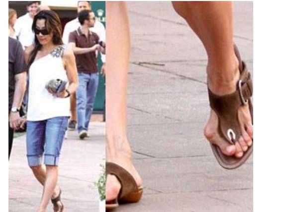 宋茜经常踩着恨天高跳舞外翻严重的大脚趾真惹人心疼