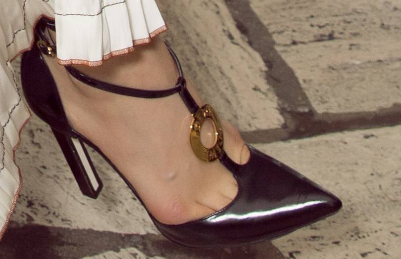 宋茜经常踩着恨天高跳舞外翻严重的大脚趾真惹人心疼