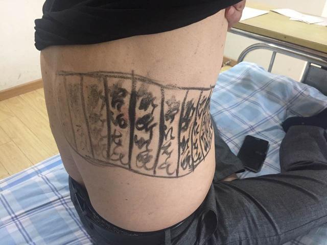 这是闹哪样？患病男子撩起上衣，腰间一&ldquo;神物&rdquo;让在场医护蒙圈啦