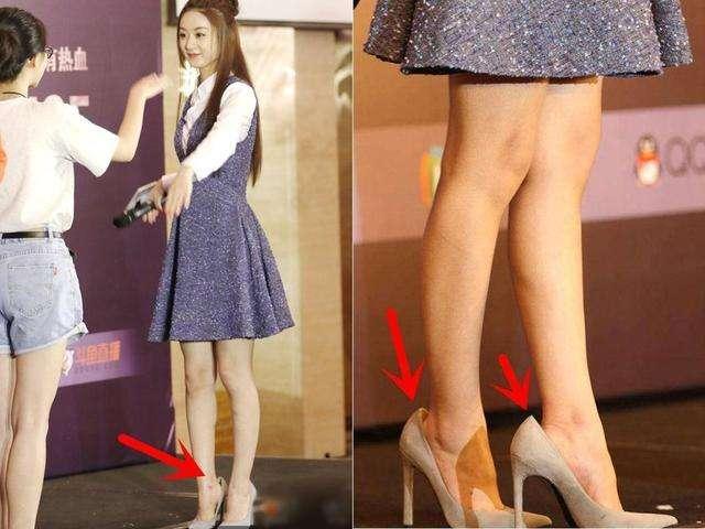 王菲把鞋放在头顶上叫时尚赵丽颖小腿抽筋了还得笑着