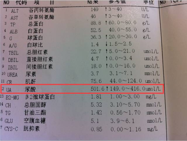 尿酸高再不注意当心痛风找上你