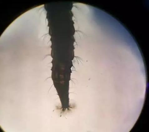 漱口时口中吐出虫子?!原因让医生都震惊