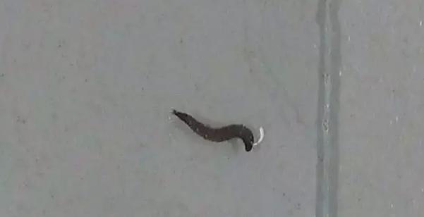 漱口时口中吐出虫子?!原因让医生都震惊