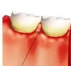 “不过，我感觉自己的牙齿还算健康啊”