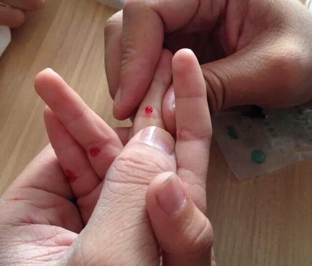 不看不知道小儿推拿与针刺调理厌食疳积效果真好宝妈日记