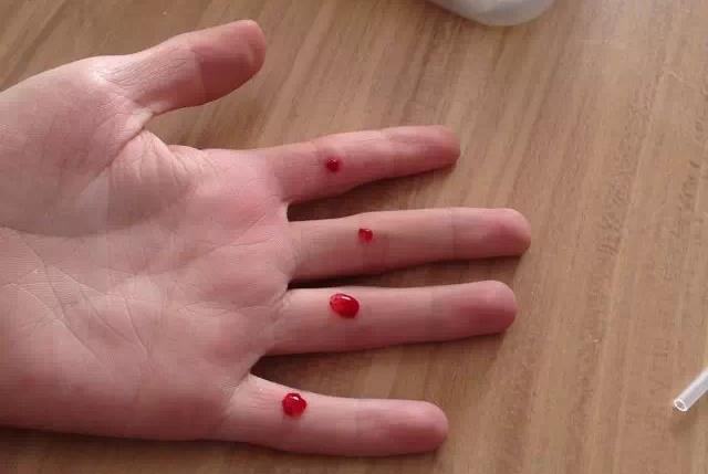 不看不知道小儿推拿与针刺调理厌食疳积效果真好宝妈日记