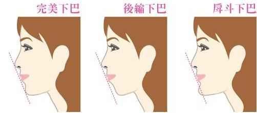 他是如何达到传说中的三点一线呢?
